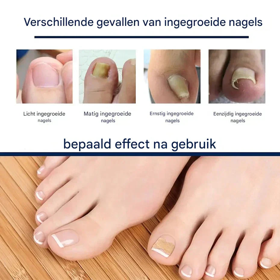 HealthyNail – Nagelpflegepflaster für ein natürliches Nagelbild