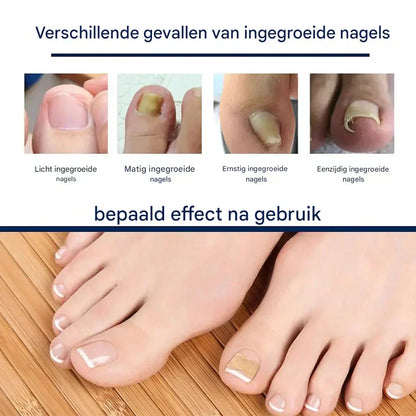 HealthyNail – Nagelpflegepflaster für ein natürliches Nagelbild