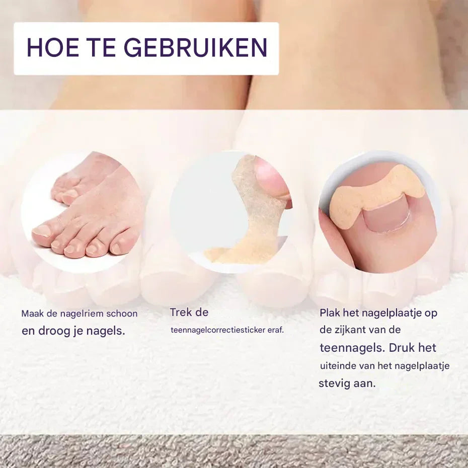 HealthyNail – Nagelpflegepflaster für ein natürliches Nagelbild