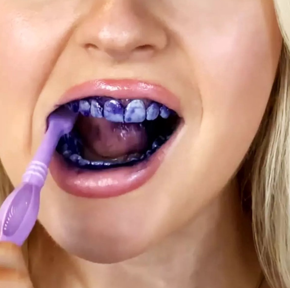 1+1 GRATIS! | V34 WhiteGlow™ | Sofortiger Effekt sichtbar nach der ersten Anwendung