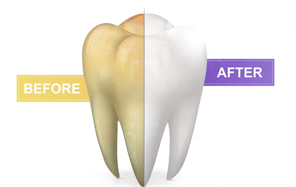 1+1 GRATIS! | V34 WhiteGlow™ | Sofortiger Effekt sichtbar nach der ersten Anwendung