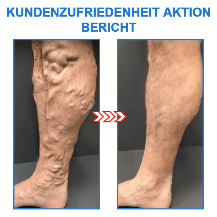 1+1 Gratis | FormSocken™ - Schlanke Beine und straffe Haut in einem Schritt!