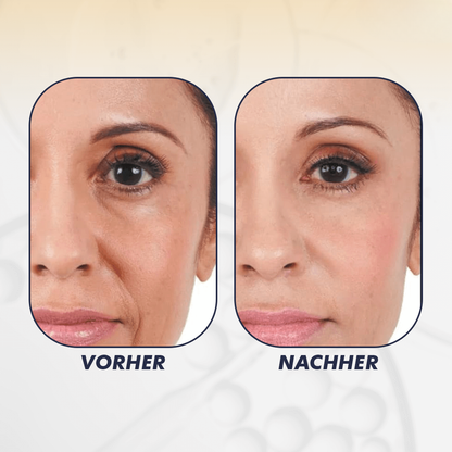 Anti-Aging Stick mit Bienengift & Peptiden für straffere Haut