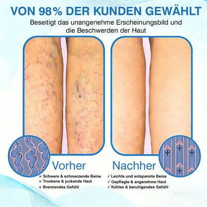 🇩🇪🏃‍🌿GFOUK® VascuCare Vein Healing Spray(Entwickelt für Krampfadern, Besenreiser, tiefe Venenthrombose (TVT), chronische venöse Insuffizienz, venöse Geschwüre, Thrombophlebitis und andere venöse Beschwerden)