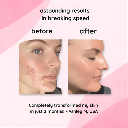 LumaSkin Radiance Pads — Peeling-Gesichtspads