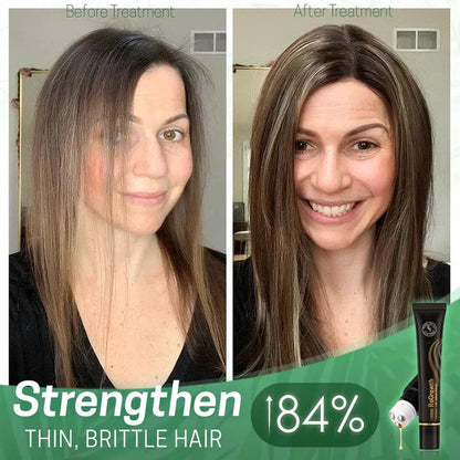 StrandSurge Serum — Haarwuchs-Serum mit Roller-Applikator