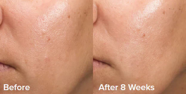 GlowEssence – Sanftes Peeling-Gel für ein glattes Hautbild