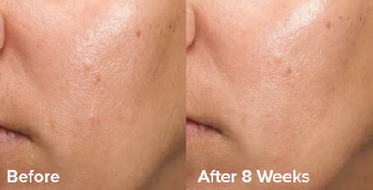 GlowEssence – Sanftes Peeling-Gel für ein glattes Hautbild