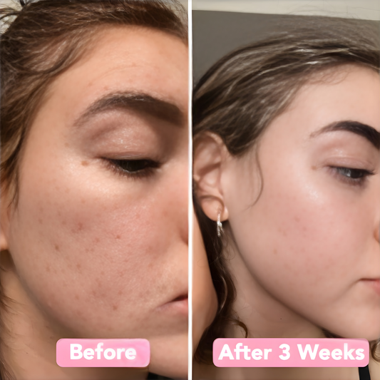 LumaSkin Radiance Pads — Peeling-Gesichtspads