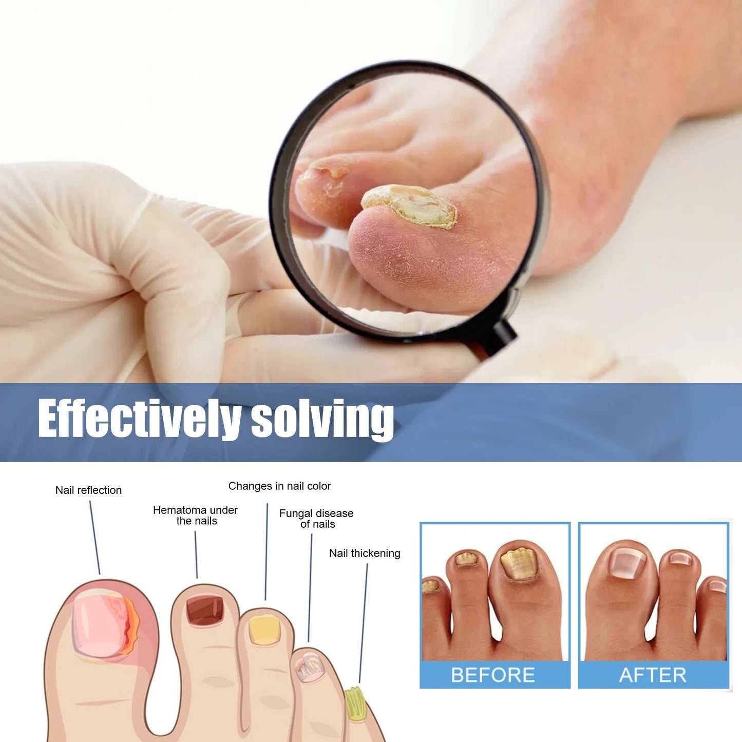 Nagelpflege-Reparatur-Patches für beschädigte und verfärbte Nägel