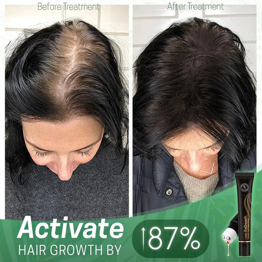 StrandSurge Serum — Haarwuchs-Serum mit Roller-Applikator