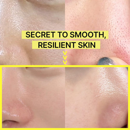 SkinShot™ Retinal Booster für jugendlich glatte Haut