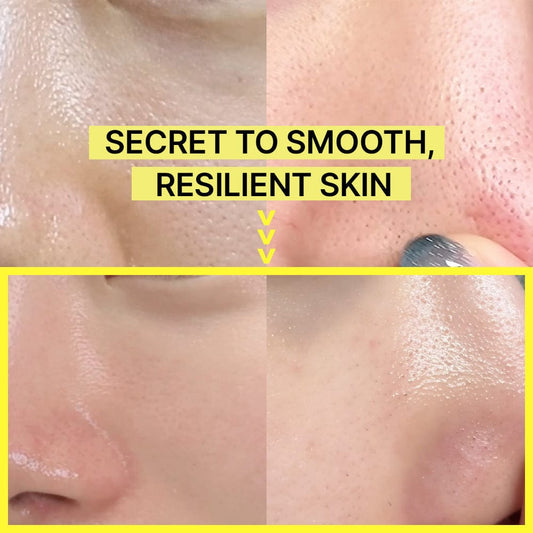 SkinShot™ | Retinal Booster für glatter & jünger aussehende Haut [1 + 1 GRATIS]