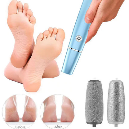 TurboSole Pro — Elektrischer Hornhautentferner für glatte Füße & einfache Fußpflege