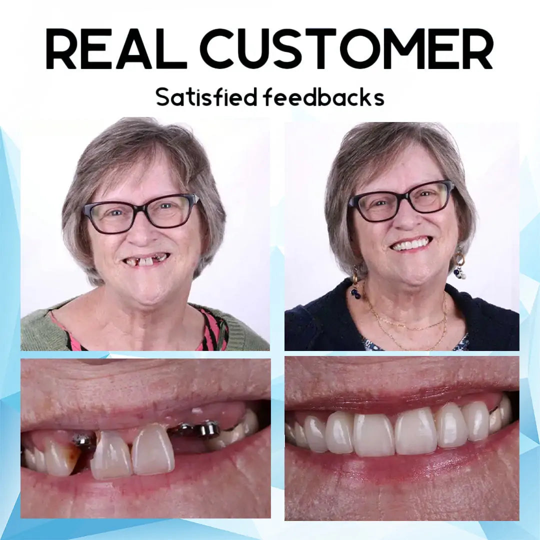 SmilePro – passgenaues Zahnprothesen-Set aus Silikon