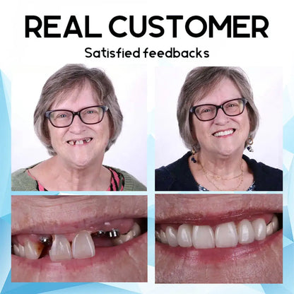SmilePro – passgenaues Zahnprothesen-Set aus Silikon