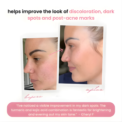 LumaSkin Radiance Pads — Peeling-Gesichtspads