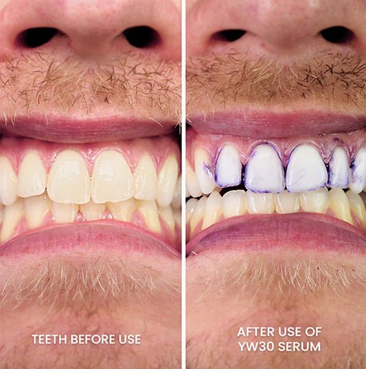 1+1 GRATIS! | V34 WhiteGlow™ | Sofortiger Effekt sichtbar nach der ersten Anwendung