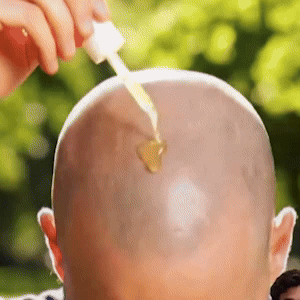 FollicleFuel – Haarpflegeserum für Kopfhaut- und Haarpflege-Routine