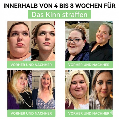 𝗠𝗼𝗿𝗶𝗻𝗴a · 𝗕erberin ＆ NAD＋10-IN-1 𝗙ortschrittliches 𝗡ano-Mikronadel-𝑷𝒇𝒍𝒂𝒔𝒕𝒆𝒓 - Für Adipositas, Herz-Kreislauf-Gesundheit, Diabetes, Schlafapnoe, Gelenkprobleme u.v.m.