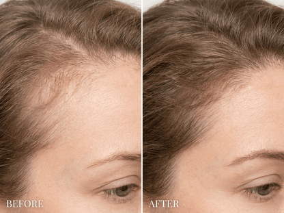 Solevia | Kopfhautmassagegerät · LED · Vibration · Öl-Infusion · Dichteres, Stärkeres Haar