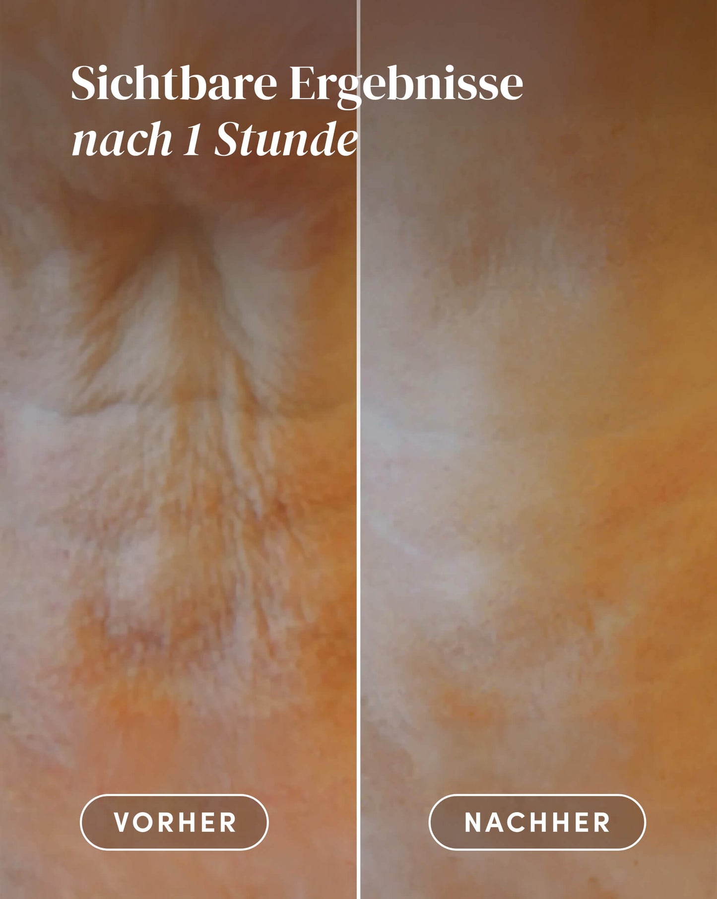 Hyaluron Gesichts- & Hals-Pads (30 Stück)