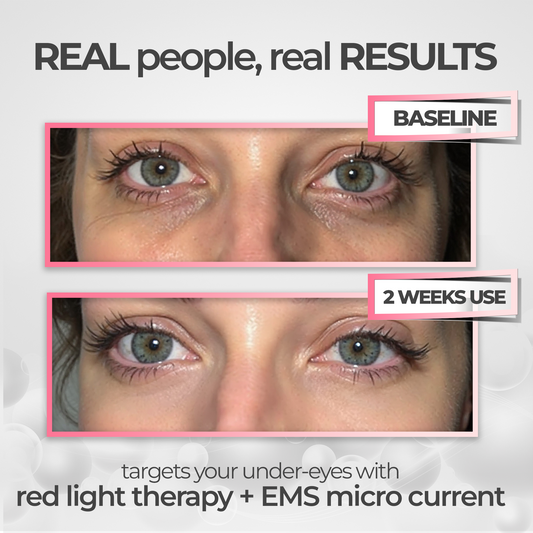 EyeRevive™ | Verabschieden Sie sich von Augenringen und Schwellungen!