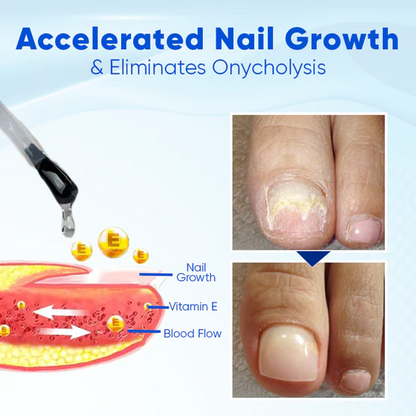 OnyxoGuard Nagelserum – Pflege für Stärke & Reparatur