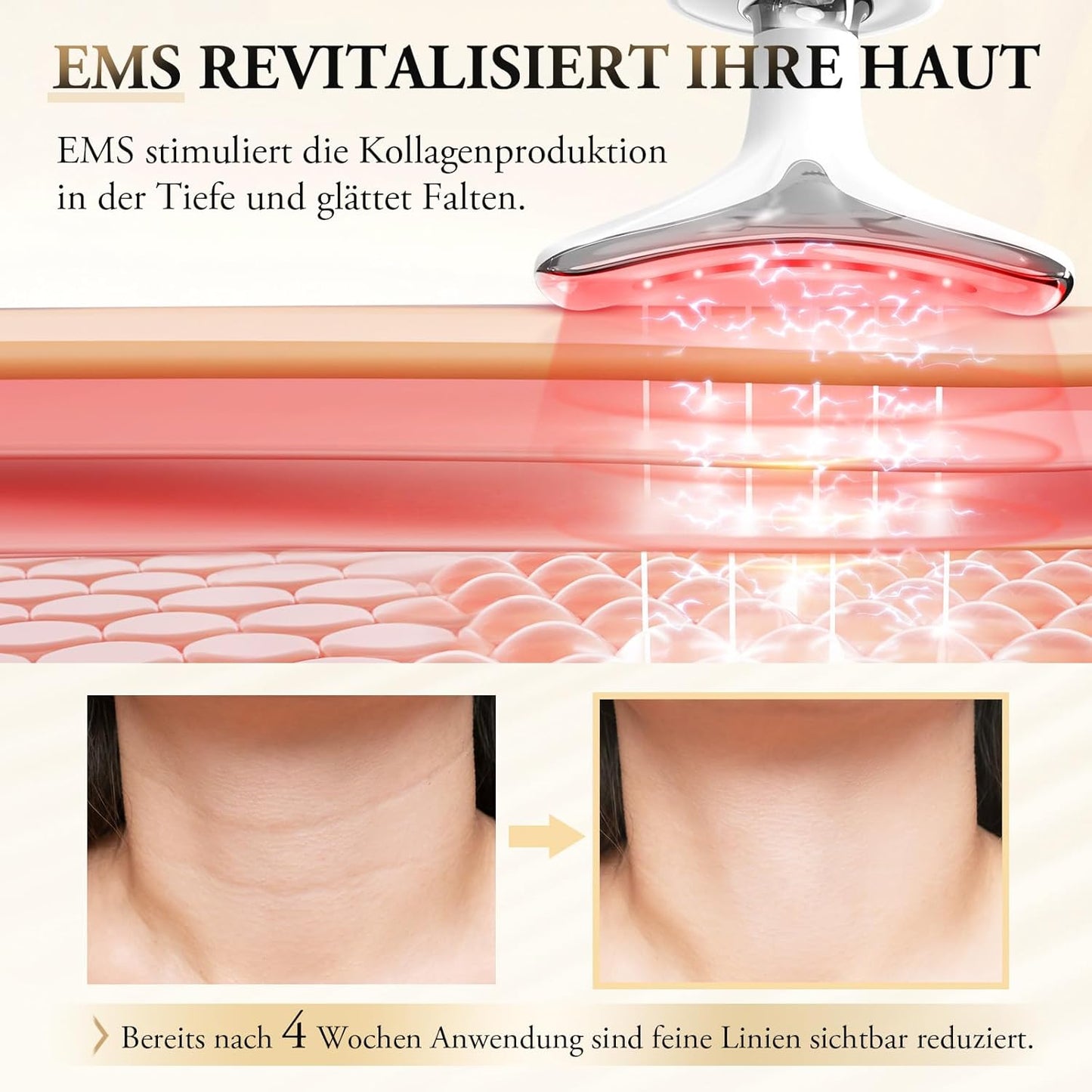 Vellista SkinLift™ | Mikrostrom & LED-Therapie für Gesicht & Hals | bekämpft Hautunreinheiten und lässt die Haut strahlen