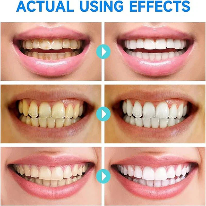 PureTeeth – Zahnpflegegel für die tägliche Mundpflegeroutine und ein gepflegtes Erscheinungsbild