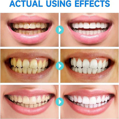 PureTeeth – Zahnpflegegel für die tägliche Mundpflegeroutine und ein gepflegtes Erscheinungsbild