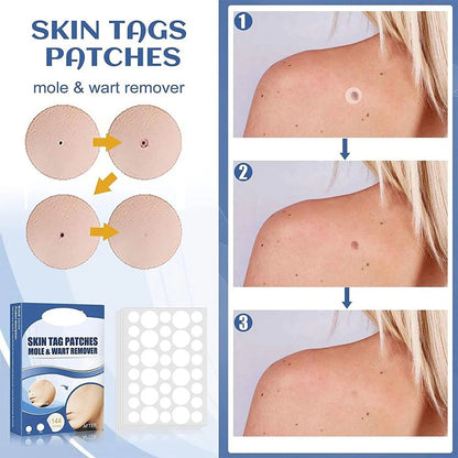 TagAway™ – Hautanhänger-Entfernungspflaster | Entfernt Skin Tags schmerzfrei in 7 Tagen