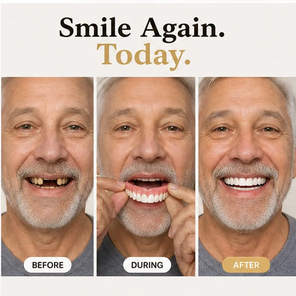 Pearlesse – Natural-Look Multi-Tonal Cosmetic Smile Veneer + 50% OFF