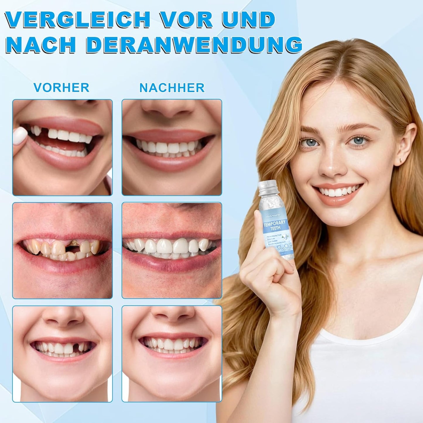 QuikSoothe™ | Keine Zahnlücken mehr – Natürliches Aussehen, schnell und einfach anwendbar